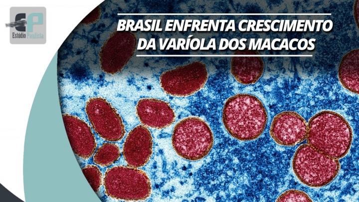 Brasil tem mais de 200 casos confirmados de varíola dos macacos